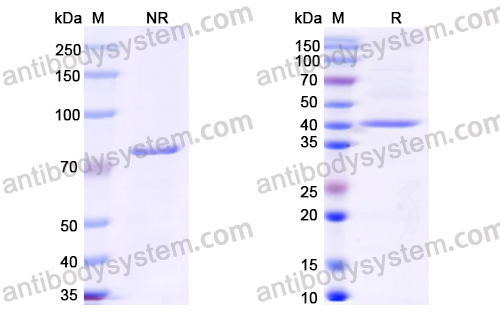 [Antibodysystem] Research Grade Radretumab