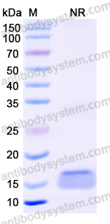 [Antibodysystem] Anti-Human CD340/ERBB2/HER2 Nanobody (SAA0836)