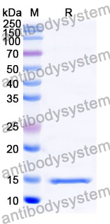 [Antibodysystem] Anti-Human CD66e/CEA/CEACAM5 Nanobody (SAA0838)