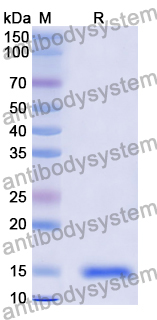 [Antibodysystem] Anti-Vibrio cholerae higB-2 Nanobody (SAA0850)