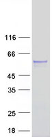 [BosterBio] TSTD2 (NM_139246) Human Recombinant Protein