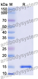 [Antibodysystem] Anti-Vibrio cholerae higB-2 Nanobody (SAA0851)