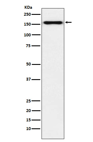 [Genscript] Desmoglein 2 Antibody, mAb, Rabbit