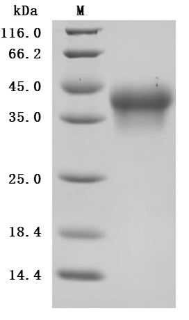 [Cusabio] Recombinant Human Interleukin-2 receptor subunit alpha (IL2RA), partial (Active)