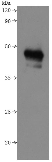 [Cusabio] Recombinant Human B-lymphocyte antigen CD20 (MS4A1)-VLPs (Active)