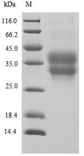 [Cusabio] Recombinant Human Programmed cell death protein 1 (PDCD1), partial (Active)