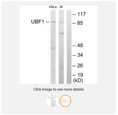 [Boster Bio] Anti-UBF1 UBTF Antibody