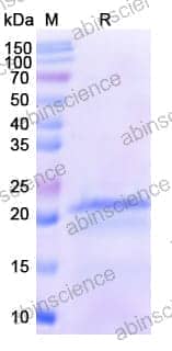 [Abinscience] Human CCL11/Eotaxin Recombinant Protein (N-His-SUMO)
