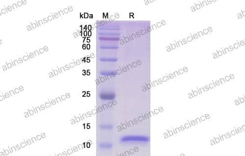 [Abinscience] Human IL8/CXCL8 Recombinant Protein (C-His)