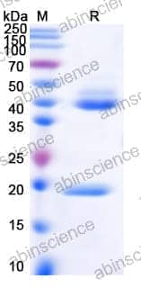 [Abinscience] Human IL23 Recombinant Protein (C-His & C-Flag)