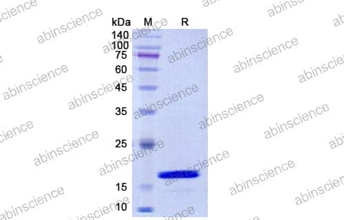 [Abinscience] Human IL21 Recombinant Protein (C-His)