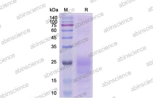[Abinsciecne] Human TSLP Recombinant Protein (C-His)
