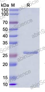 [Abinscience] Human IL27A/IL30 Recombinant Protein (N-His)