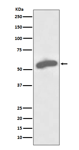 [Genscript] G6PD Antibody, mAb, Rabbit