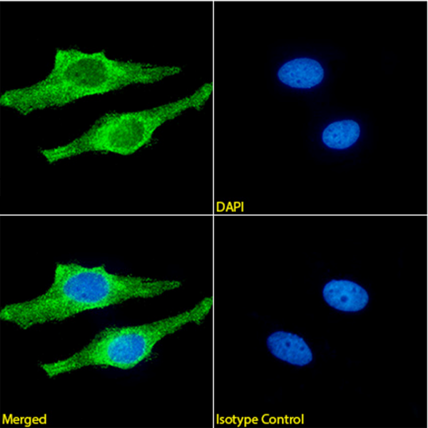 [MyBioSource] Amyloid Beta (APP) Antibody