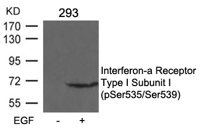 [Signalway Antibody] IFNAR1 Subunit1 (phospho-Ser535/Ser539) Antibody