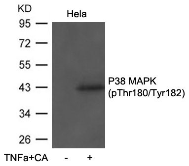 [Signalway Antibody] P38 MAPK(Phospho-Thr180/Tyr182) antibody