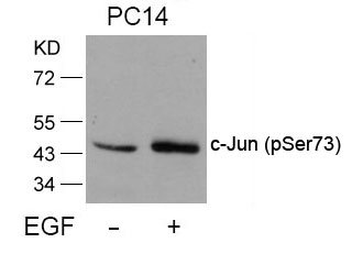 [Signalway Antibody] c-Jun(Phospho-Ser73) Antibody
