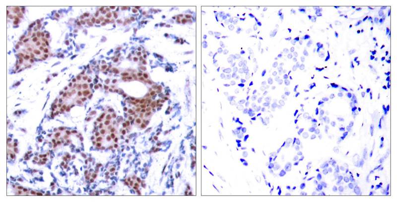[Signalway Antibody] Elk-1(Phospho-Ser383) Antibody