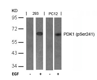 [Signalway Antibody] PDK1(Phospho-Ser241) Antibody