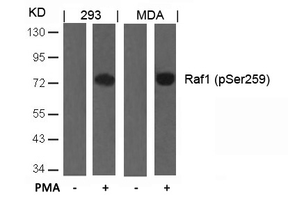 [Signalway Antibody] Raf1(Phospho-Ser259) Antibody