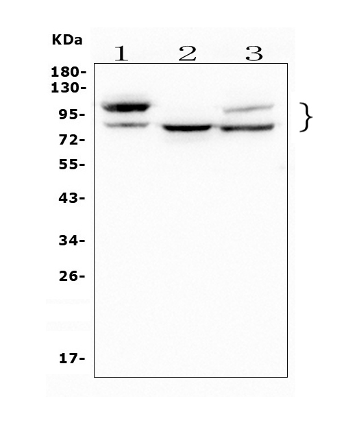 [BosterBio] Anti-GAA Antibody Picoband® (monoclonal, 2G7)