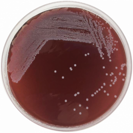 [Condalab] Tryptose Blood Agar Base
