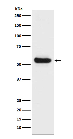 [Genscript] Lipoprotein lipase Antibody, mAb, Rabbit