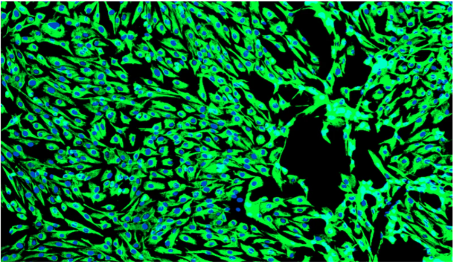 [Vitro Biopharma] New Gastric Cancer-Associated Fibroblasts