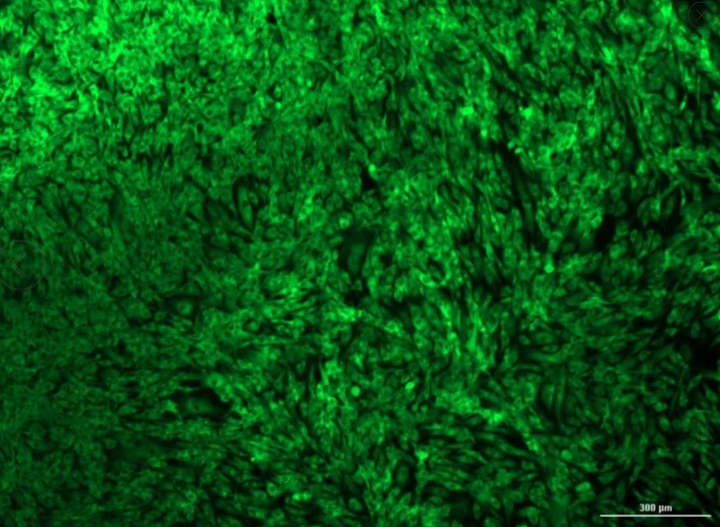 [Vitro Biopharma] Human Breast Carcinoma Cancer-Associated Fibroblasts (CAFs): 1,000,000 Cells
