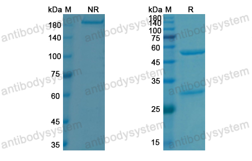 [Antibodysystem] Research Grade Evinacumab