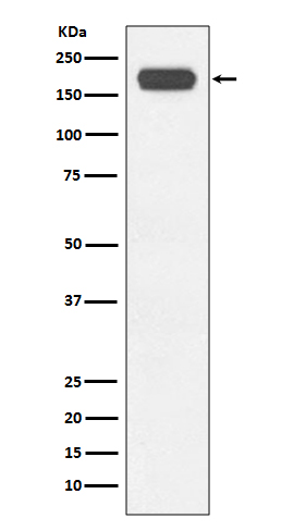 [Genscript] SMARCA4 Antibody, mAb, Rabbit