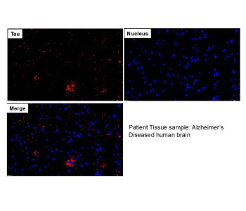[ICL lab] Anti-Tau Antibody - Monoclonal