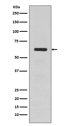 [Genscript] TGFBI Antibody, mAb, Rabbit