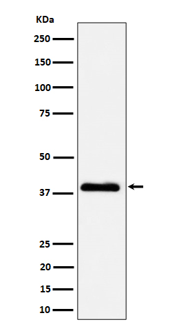 [Genscript] NSDHL Antibody, mAb, Rabbit
