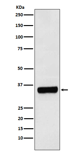 [Genscript] PRKRA Antibody, mAb, Rabbit
