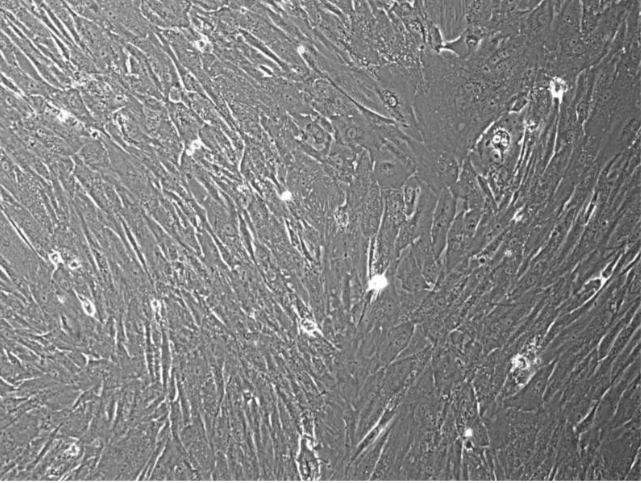 [Vitro Biopharma] Melanoma Cancer-Associated Fibroblasts, MSC-GRO™ Low Serum Complete MSC Medium 