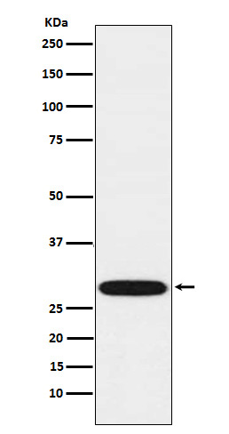 [Genscript] PTX3 Antibody, mAb, Rabbit