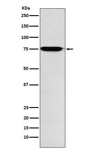 [Genscript] Lysosomal alpha glucosidase Antibody, mAb, Rabbit