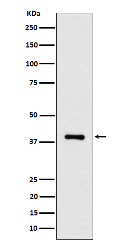[Genscript] ACAT2 Antibody, mAb, Rabbit