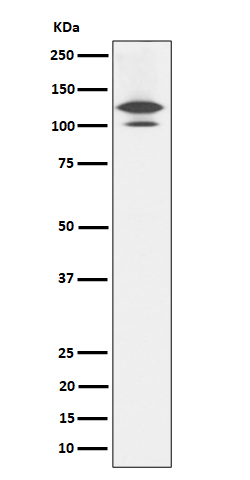[Genscript] RASA1 Antibody, mAb, Rabbit