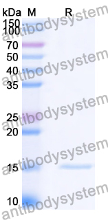 [Antibodysystem] Anti-Vibrio cholerae higB-2 Nanobody (SAA0852)