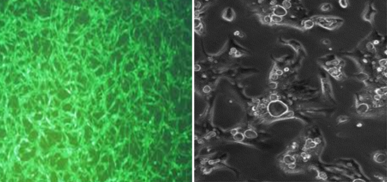 [Neuromics] GFP Expressing Human Gastric Carcinoma N87 Cells 