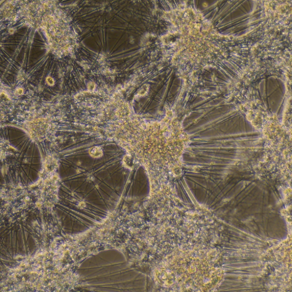 [Neuromics] Human iPSC - Dopaminergic Neurons