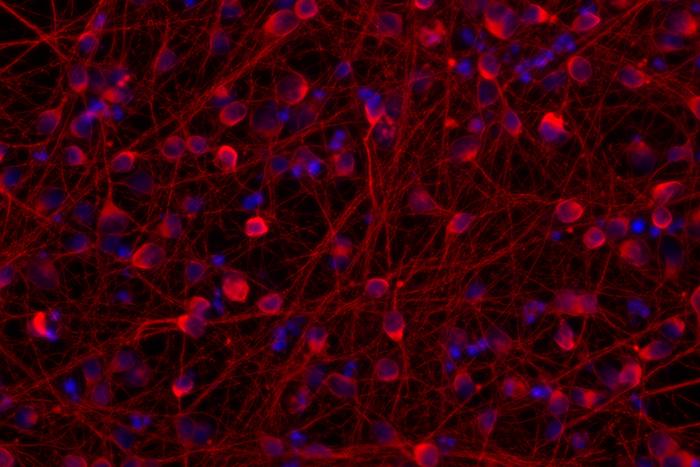 [Neuromics] Human iPSC - Cortical GABAergic Neurons