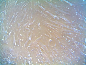 [Neuromics] Human Pancreatic Fibroblast Cells 