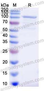 [Antibodysystem] Recombinant Human adenovirus 5/HAdV-5 L3/CP-H/Protein II Protein, N-His