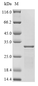 [Cusabio] Recombinant Mycobacterium tuberculosis ESAT-6-like protein EsxB (esxB)