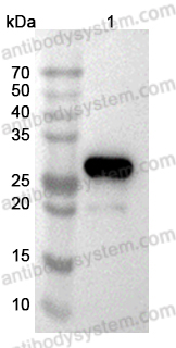 [Antibodysystem] Anti-E1B-55K/E1B-495R Polyclonal Antibody