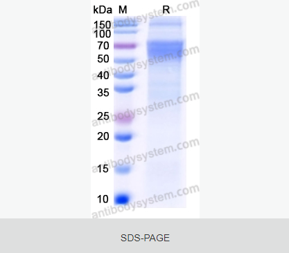 [Antibodysystem] Recombinant Rabies virus/RABV G/Glycoprotein Protein, C-10*His